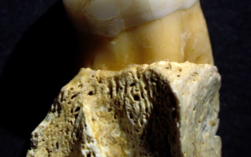 Primer molar humano Axlor