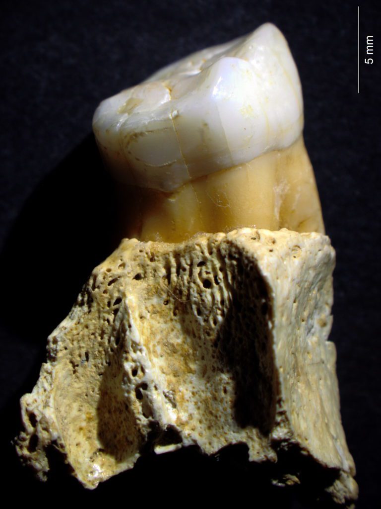 Primer molar humano Axlor