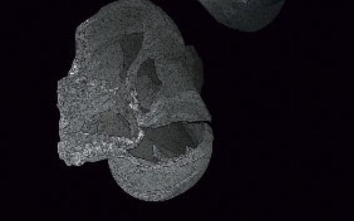 Praefocabilis sacculi