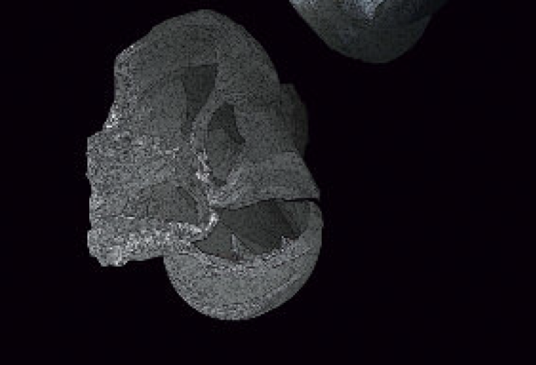 Praefocabilis sacculi